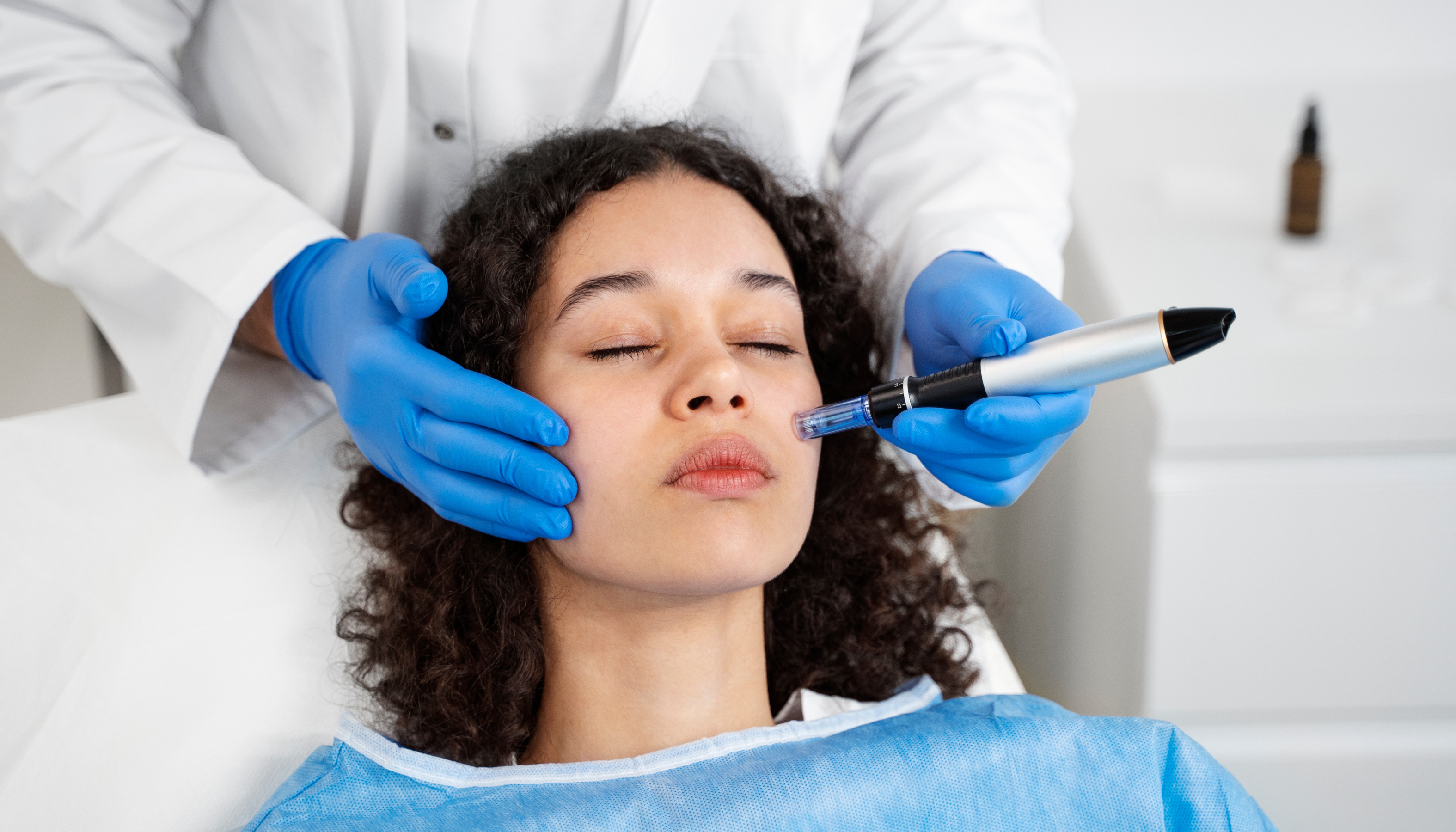 Microneedling